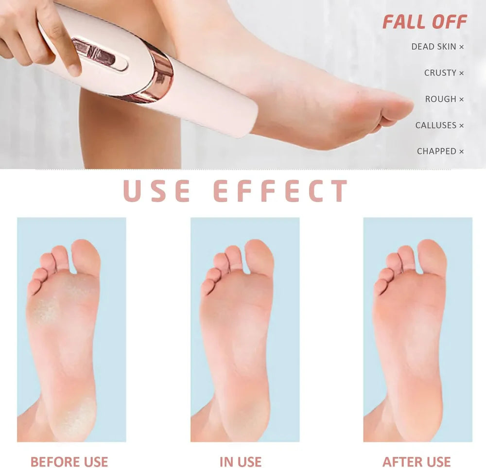 A foot care product being used on a foot with before, during, and after effects shown.