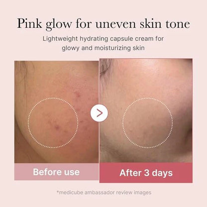 Before and after comparison of skin tone improvement with a cream product, showing a pink glow for uneven skin tone.