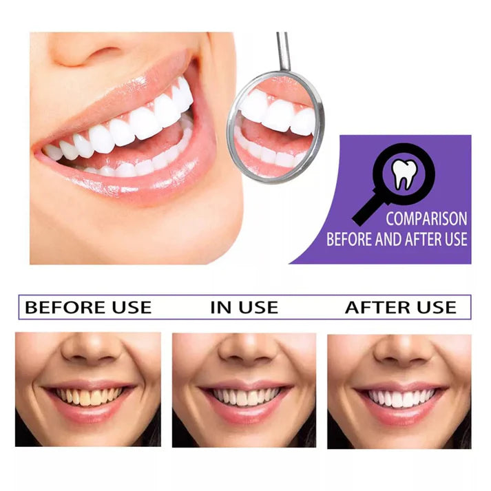 Before and after use comparison of dental whitening with a mirror and smiling faces.